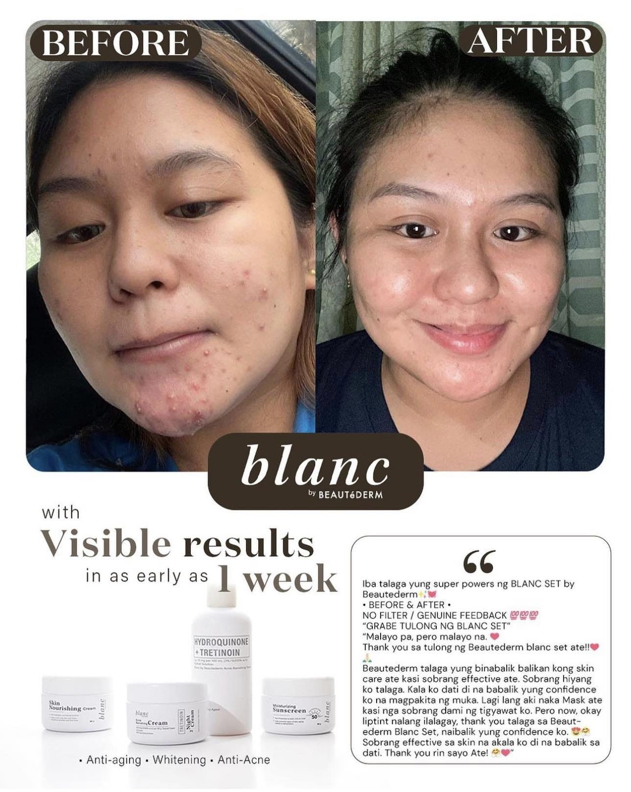 Beaute Blanc Trial Set